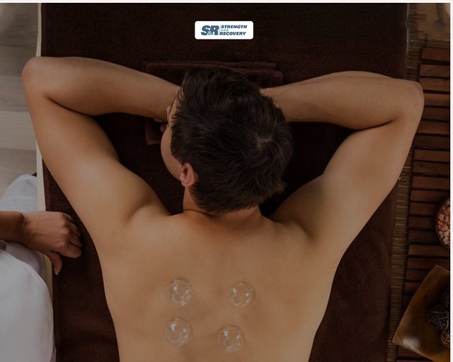 Acupuncture Suction Cups – Acupuncture Cupping Supplies