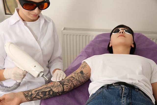 Professional Laser Tattoo Removal Machine